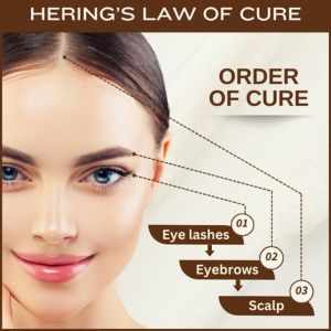 hering's law of cure